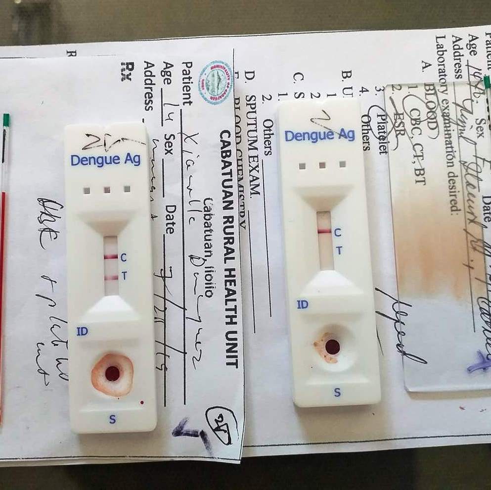 POSITIVE OR NEGATIVE? Two red lines in this dengue test kit mean the patient has the dengue virus. A single red line means the patient is negative of the virus. People have been rushing to rural health units and the Iloilo provincial government’s 12 hospitals for dengue tests to know if they have the dengue virus, resulting to a shortage in dengue test kits. Health secretary Francisco Duque has promised to deliver 18,375 dengue test kits to Western Visayas. IME SORNITO/PN