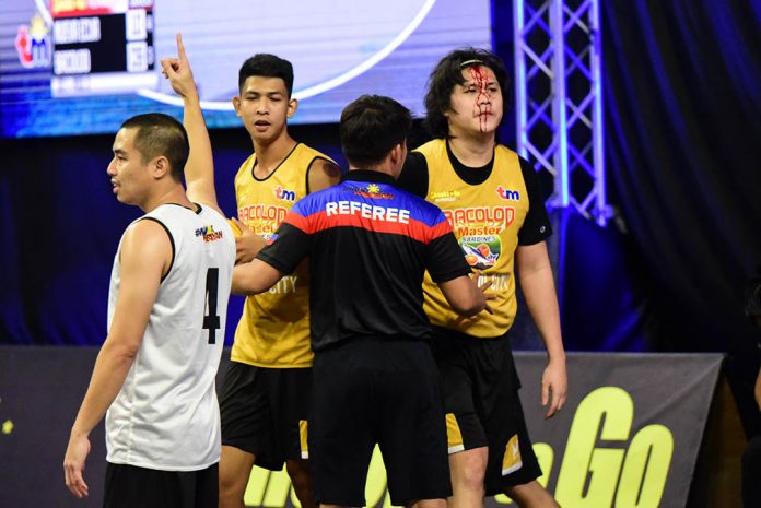 Bacolod-Master Sardines’ Alfred Batino suffered a cut above his forehead during their Pool D match against the Nueva Ecija Rice Vanguards. PHOTO COURTESY OF CHOOKS-TO-GO PILIPINAS/FB