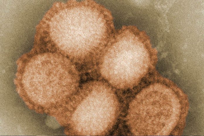 This digitally-colorized, negative-stained transmission electron microscopic image depicts some of the ultrastructural morphology of the A/CA/4/09 Swine Flu virus. CDC