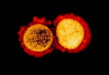 Transmission electron micrograph of SARS-CoV-2 virus particles. NIAID