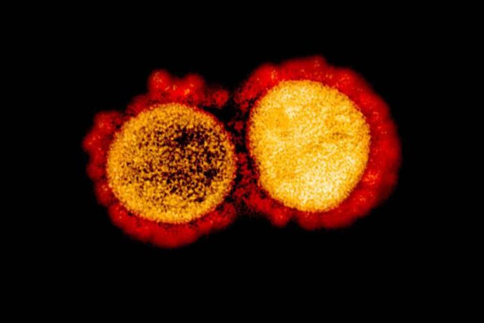 Transmission electron micrograph of SARS-CoV-2 virus particles. NIAID