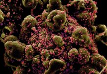 Colorized scanning electron micrograph of an apoptotic cell (greenish brown) heavily infected with SARS-COV-2 virus particles (pink), also known as novel coronavirus, isolated from a patient sample. National Institute of Allergy and Infectious Diseases, NIH/Handout via REUTERS.