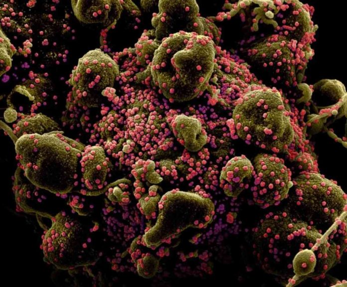 Colorized scanning electron micrograph of an apoptotic cell (greenish brown) heavily infected with SARS-COV-2 virus particles (pink), also known as novel coronavirus, isolated from a patient sample. National Institute of Allergy and Infectious Diseases, NIH/Handout via REUTERS.