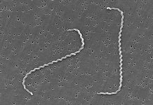 Electronic image of Leptospira interrogans. CDC/NCID/HIP/Janice Carr (PHIL #1220)