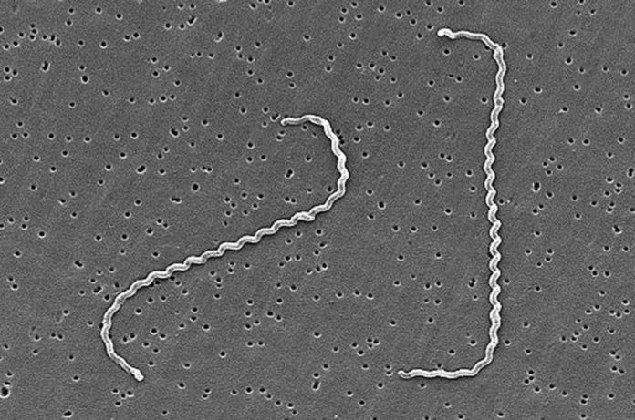 Electronic image of Leptospira interrogans. CDC/NCID/HIP/Janice Carr (PHIL #1220)