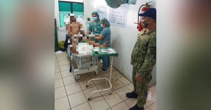 A 32-year-old man attending a birthday party was hacked by the celebrator’s brother on May 28 in Calatrava, Negros Occidental. NOCPPO CALATRAVA MPS/VIA RADYO BANDERA BACOLOD