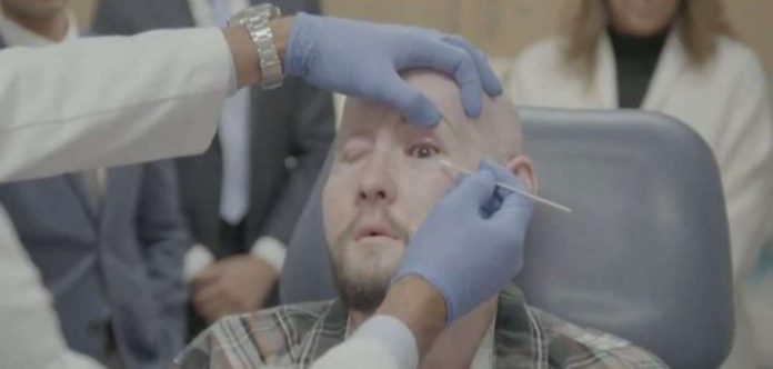 Aaron James, who survived a high-voltage electrical accident, underwent 21 hours of surgery that replaced half of his face. BBC