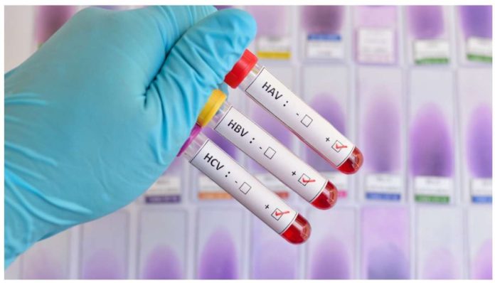 Blood samples testing positive for three (of five) main strains of the hepatitis virus. INQUIRER.NET STOCK IMAGE