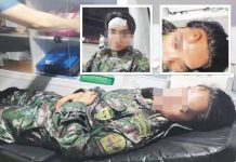 This member of the Philippine National Police’s Special Action Force undergoes treatment for a head injury after being struck with a mobile phone by former President Rodrigo Duterte’s common-law wife, Honeylet Avanceña.